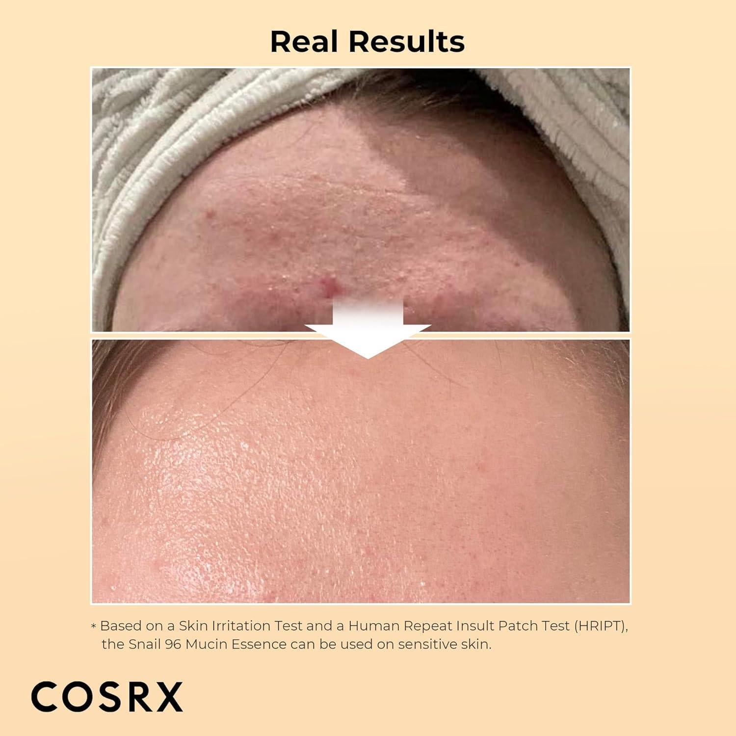 Cosrx Advanced Snail 96 Mucin Power Essence